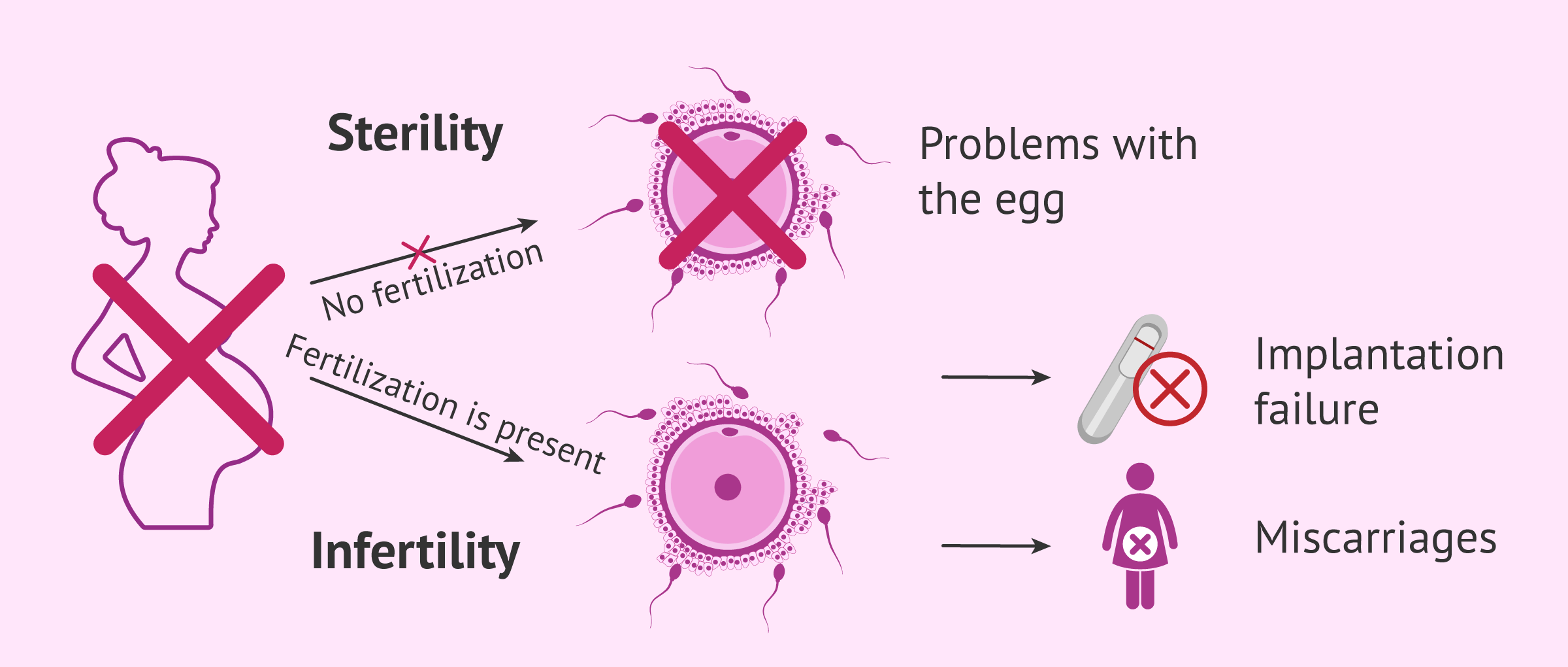 sterily-infertility-in-women.png